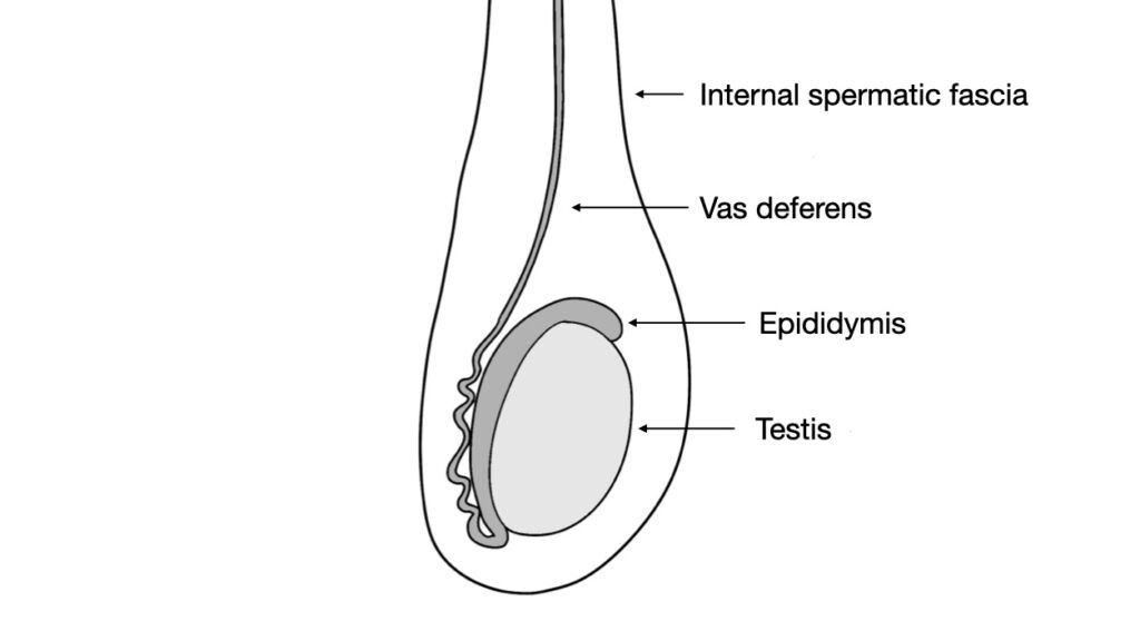 testis with epididymis and vas deferens in internal spermatic fascia - John Curington MD